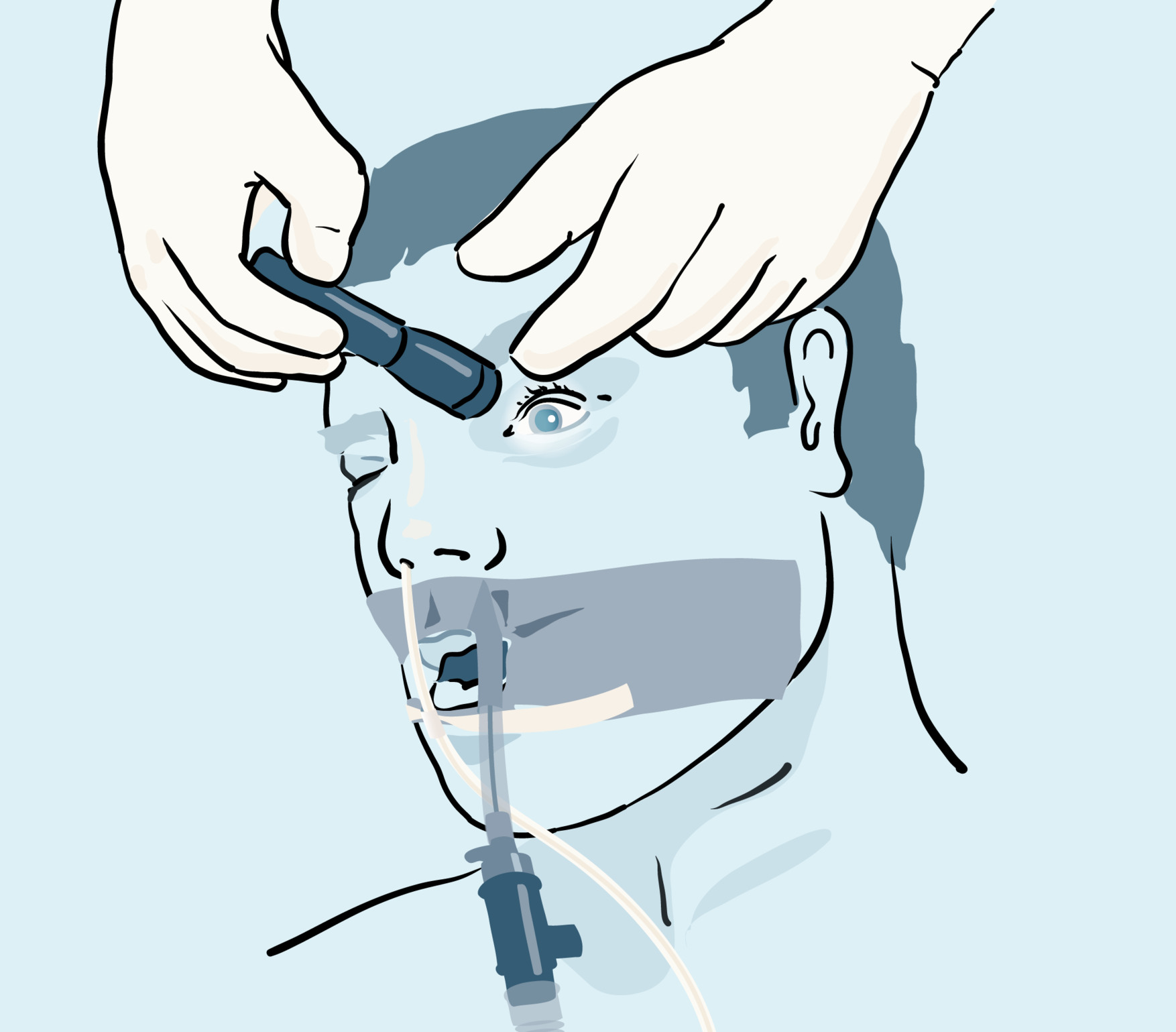 Bild av undersökning av pupillreflexen